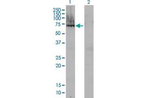 Western Blotting (WB) image for anti-alpha-Fetoprotein (AFP) (AA 500-609) antibody (ABIN559807)