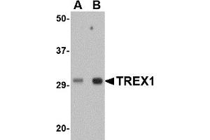 Western Blotting (WB) image for anti-three Prime Repair Exonuclease 1 (TREX1) (Middle Region) antibody (ABIN1031144) (TREX1 抗体  (Middle Region))
