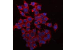 IF analysis of QPRT using anti-QPRT antibody (ABIN7600821). (QPRT 抗体  (AA 24-297))