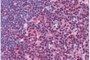 Immunohistochemistry (Formalin-fixed Paraffin-embedded Sections) (IHC (fp)) image for anti-Signal Transducer and Activator of Transcription 3 (Acute-Phase Response Factor) (STAT3) (AA 683-732) antibody (ABIN604780)