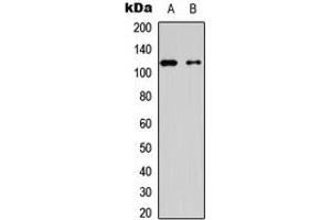 Western blot analysis of Hexokinase 1 expression in HEK293T (A), mouse brain (B) whole cell lysates. (Hexokinase 1 抗体  (N-Term))