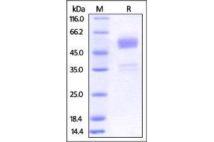 Human BTLA (31-150), Fc Tag on SDS-PAGE under reducing (R) condition. (BTLA Protein (AA 31-150) (Fc Tag))