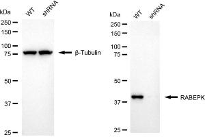 Western blotting analysis using RABEPK antibody (ABIN7800108). (Recombinant RABEPK 抗体)