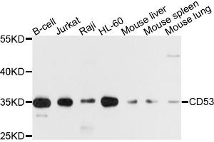 Western blot analysis of extracts of various cell lines, using CD53 antibody. (CD53 抗体)