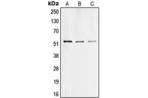 Western blot analysis of Collagen 26 alpha 1 expression in Hela (A), PC12 (B), H9C2 (C) whole cell lysates. (Collagen, Type XXVI, alpha 1 (COL26A1) (Center) 抗体)