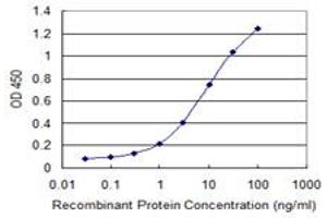Detection limit for recombinant GST tagged UGT1A10 is 0. (UGT1A10 抗体  (AA 187-289))