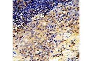 IHC analysis of FFPE human tonsil tissue stained with CD8A antibody (CD8 alpha 抗体  (AA 59-88))