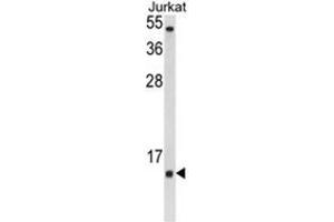 Western blot analysis of SOD1 Antibody (Center) in Jurkat cell line lysates (35ug/lane). (SOD1 抗体  (Middle Region))