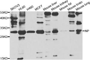 Western blot analysis of extracts of various cell lines, using PNP antibody (ABIN5973400) at 1/1000 dilution. (PNP 抗体)