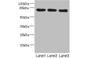 Western blot All lanes: BBS2 antibody at 5. (BBS2 抗体  (AA 1-96))