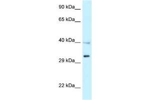 WB Suggested Anti-TNFRSF14 Antibody Titration: 1. (HVEM 抗体  (Middle Region))