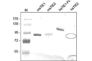 Western analysis of recombinant Human and Mouse sTIE-1 and sTIE-2 using a Polyclonal antibody directed against Mouse recombinant sTIE-1. (TIE1 抗体  (AA 22-748))