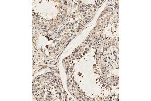 (ABIN657991 and ABIN2846937) staining Dyrk2 in human testis tissue sections by Immunohistochemistry (IHC-P - paraformaldehyde-fixed, paraffin-embedded sections). (DYRK2 抗体  (C-Term))