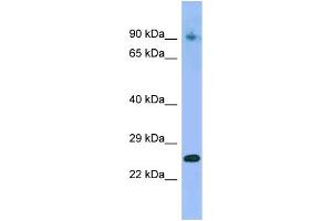 WB Suggested Anti-IFNA4 Antibody Titration: 1. (IFNA4 抗体  (C-Term))