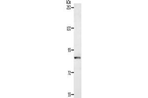 Gel: 8 % SDS-PAGE, Lysate: 40 μg, Lane: Human fetal liver tissue, Primary antibody: ABIN7128148(ACAD11 Antibody) at dilution 1/400, Secondary antibody: Goat anti rabbit IgG at 1/8000 dilution, Exposure time: 1 minute (ACAD11 抗体)