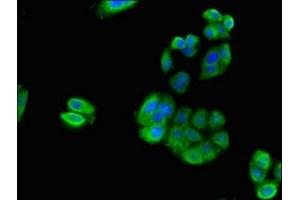 Immunofluorescent analysis of HepG2 cells using ABIN7142516 at dilution of 1:100 and Alexa Fluor 488-congugated AffiniPure Goat Anti-Rabbit IgG(H+L) (RPS21 抗体  (AA 1-81))