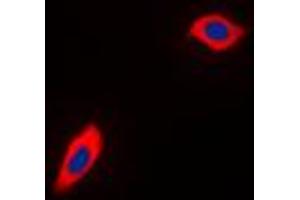 Immunofluorescent analysis of PEX11B staining in THP1 cells. (PEX11B 抗体  (Center))