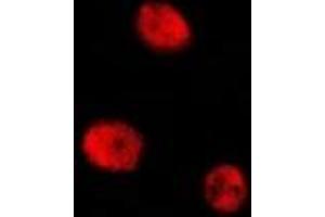 Immunofluorescence (IF) image for anti-cAMP Responsive Element Binding Protein 1 (CREB1) (pSer129) antibody (ABIN7303568)