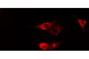 ABIN6269319 staining Hela cells by IF/ICC. (PKC theta 抗体  (C-Term))