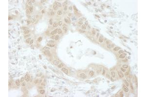 Immunohistochemistry (IHC) image for anti-TIP41-like protein (TIPRL) (C-Term) antibody (ABIN7448836) (TIPRL 抗体  (C-Term))