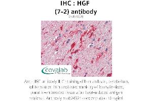 Image no. 1 for anti-Hepatocyte Growth Factor (Hepapoietin A, Scatter Factor) (HGF) antibody (ABIN1723243) (HGF 抗体)