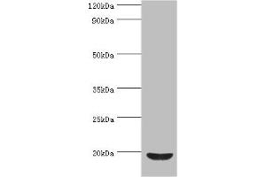 Western blot All lanes: Low molecular weight phosphotyrosine protein phosphatase antibody at 4 μg/mL + HepG2 whole cell lysate Secondary Goat polyclonal to rabbit IgG at 1/10000 dilution Predicted band size: 19, 18, 15, 13 kDa Observed band size: 19 kDa (ACP1 抗体  (AA 1-158))