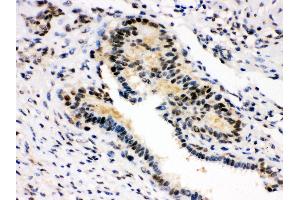 Immunohistochemistry (IHC) image for anti-Survival of Motor Neuron 1, Telomeric (SMN1) (AA 22-52), (N-Term) antibody (ABIN3043933)