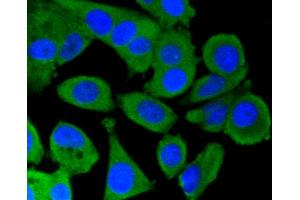Immunofluorescence analysis of MCF-7 cells using PRKCA antibody (ABIN5997085). (PKC alpha 抗体)