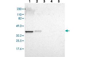 Western blot analysis of Lane 1: RT-4, Lane 2: U-251 MG, Lane 3: Human Plasma, Lane 4: Liver, Lane 5: Tonsil with ARPC1A polyclonal antibody  at 1:250-1:500 dilution. (ARPC1A 抗体)