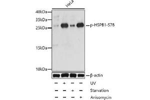 Western blot analysis of extracts of HeLa cells using Phospho-HSPB1(S78) Polyclonal Antibody at dilution of 1:1000. (HSP27 抗体  (pSer78))