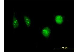 Immunofluorescence of monoclonal antibody to DCK on HeLa cell. (DCK 抗体  (AA 161-260))