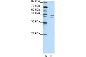 WB Suggested Anti-ZNF419A Antibody Titration:  2. (ZNF419 抗体  (C-Term))