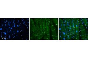 Rabbit Anti-AMOT Antibody    Formalin Fixed Paraffin Embedded Tissue: Human Adult heart  Observed Staining: Membrane(tight junctions - intercalated disks) Primary Antibody Concentration: 1:600 Secondary Antibody: Donkey anti-Rabbit-Cy2/3 Secondary Antibody Concentration: 1:200 Magnification: 20X Exposure Time: 0. (Angiomotin 抗体  (N-Term))