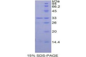 SDS-PAGE analysis of Human STAT6 Protein. (STAT6 蛋白)