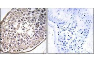 Immunohistochemistry analysis of paraffin-embedded human testis tissue, using DNAL4 Antibody. (DNAL4 抗体  (AA 1-50))