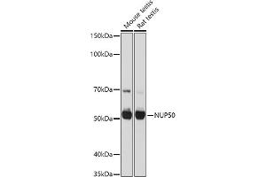 Western blot analysis of extracts of various cell lines, using NUP50 antibody (ABIN6128364, ABIN6144963, ABIN6144964 and ABIN6225005) at 1:1000 dilution. (NUP50 抗体  (AA 299-468))
