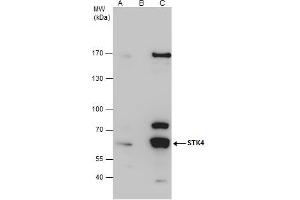 Immunoprecipitation (IP) image for anti-serine/threonine Kinase 4 (STK4) (C-Term) antibody (ABIN2856667)