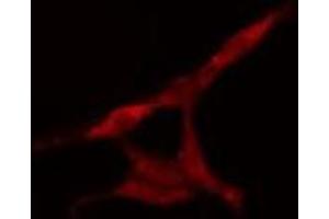ABIN6277591 staining HeLa cells by IF/ICC. (KIF2C 抗体  (C-Term))
