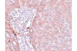 Immunohistochemical staining of rat liver tissue with NDUFB9 polyclonal antibody  at 5 ug/mL dilution. (NDUFB9 抗体  (C-Term))