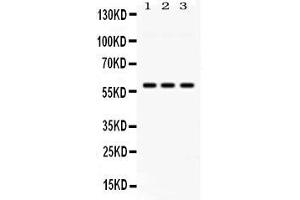 Western blot analysis of PIAS4 expression in rat testis extract ( Lane 1), mouse testis extract ( Lane 2) and HELA whole cell lysates ( Lane 3). (PIAS4 抗体  (N-Term))