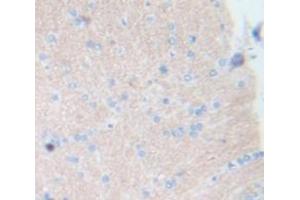 IHC-P analysis of Kidney tissue, with DAB staining. (Integrin alpha 1 抗体  (AA 119-355))