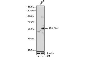 Western blot analysis of extracts of Jurkat cells, using Phospho-LCK-Y394 antibody (ABIN3019739, ABIN3019740, ABIN3019741 and ABIN7101863) at 1:1000 dilution. (LCK 抗体  (pTyr394))