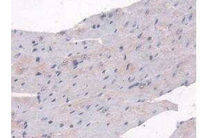 Immunohistochemistry (IHC) image for anti-Sulfatase 2 (SULF2) (AA 337-654) antibody (ABIN7441439)