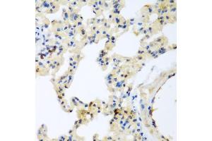 Immunohistochemistry of paraffin-embedded rat lung using LEPREL2 antibody (ABIN5971278) at dilution of 1/200 (40x lens). (LEPREL2 抗体)