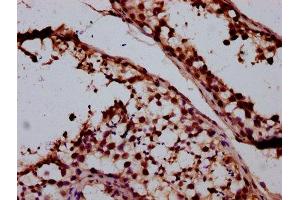 IHC image of ABIN7170858 diluted at 1:400 and staining in paraffin-embedded human testis tissue performed on a Leica BondTM system.