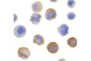 Immunocytochemistry of IRAK in HeLa cells with AP30438PU-N IRAK antibody at 10 μg/ml.