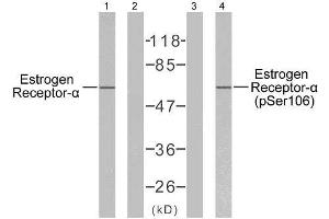 Western blot analysis of extracts from MCF7 cells, using Estrogen Receptor-α (Ab-106) antibody (E021066) and Estrogen Receptor-α (phospho-Ser106) antibody (E011071). (Estrogen Receptor alpha 抗体  (pSer106))