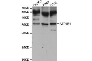 Western blot analysis of extracts of various cell lines, using ATP1B1 antibody. (ATP1B1 抗体)