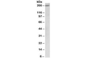Western blot testing of human albumin-depleted serum lysate with alpha-2-macroglobulin antibody at 0. (alpha 2 Macroglobulin 抗体)
