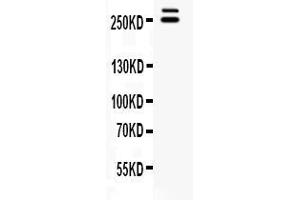 Western blot analysis of WNK1 expression in rat testis extract ( Lane 1). (WNK1 抗体  (Middle Region))